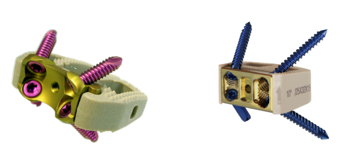 Chunli Medical's "Self - Stabilizing Interbody Fusion Cage" Has Obtained Marketing Authorization!