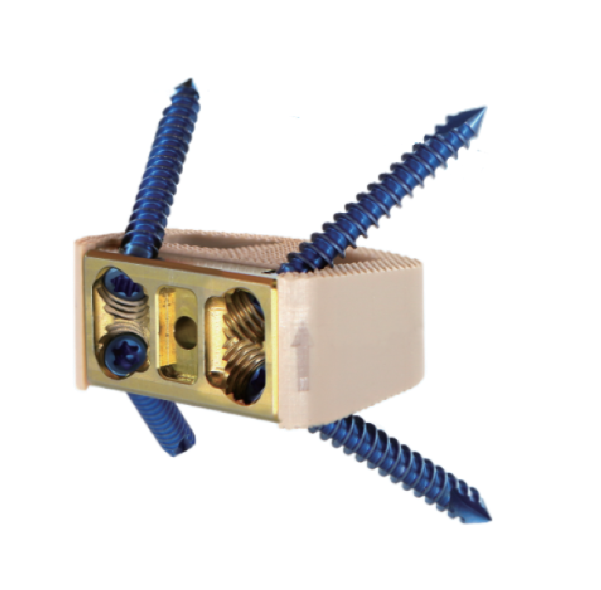 Self-Stabilizing Interbody Fusion Cage